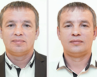 Процедура контурной пластики лица с использованием филлеров последнего поколения NATURELIZE FACIAL ARTS